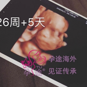 ̩ԹӤ26+5죬ͻ